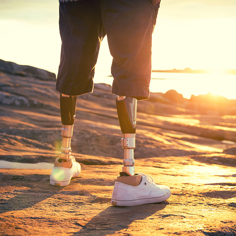 old pic of guys first prosthetic legs standing by the beach