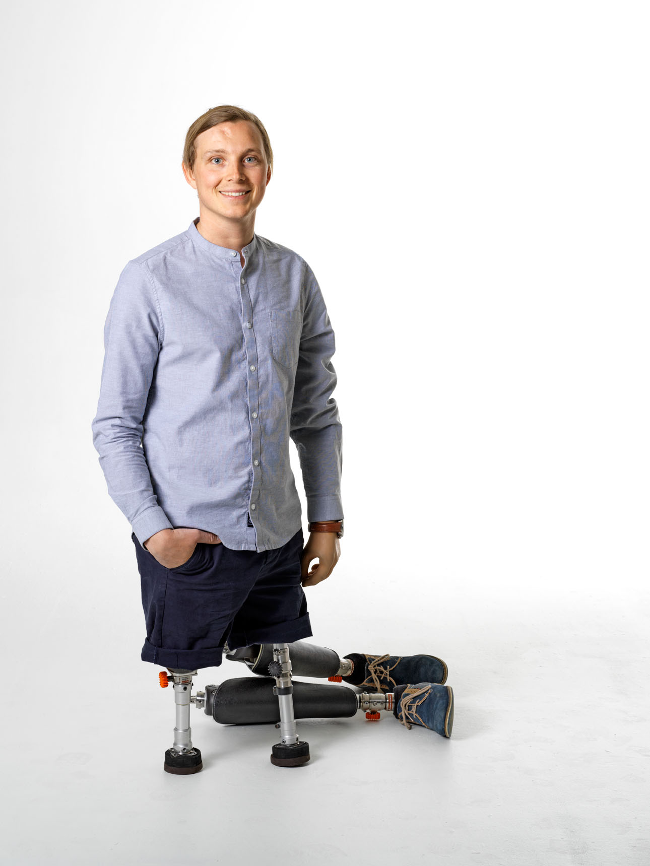 Christoffer Lindhe in a blue shirt with shorts standing on his short prosthetic legs with Xtend Connect attached