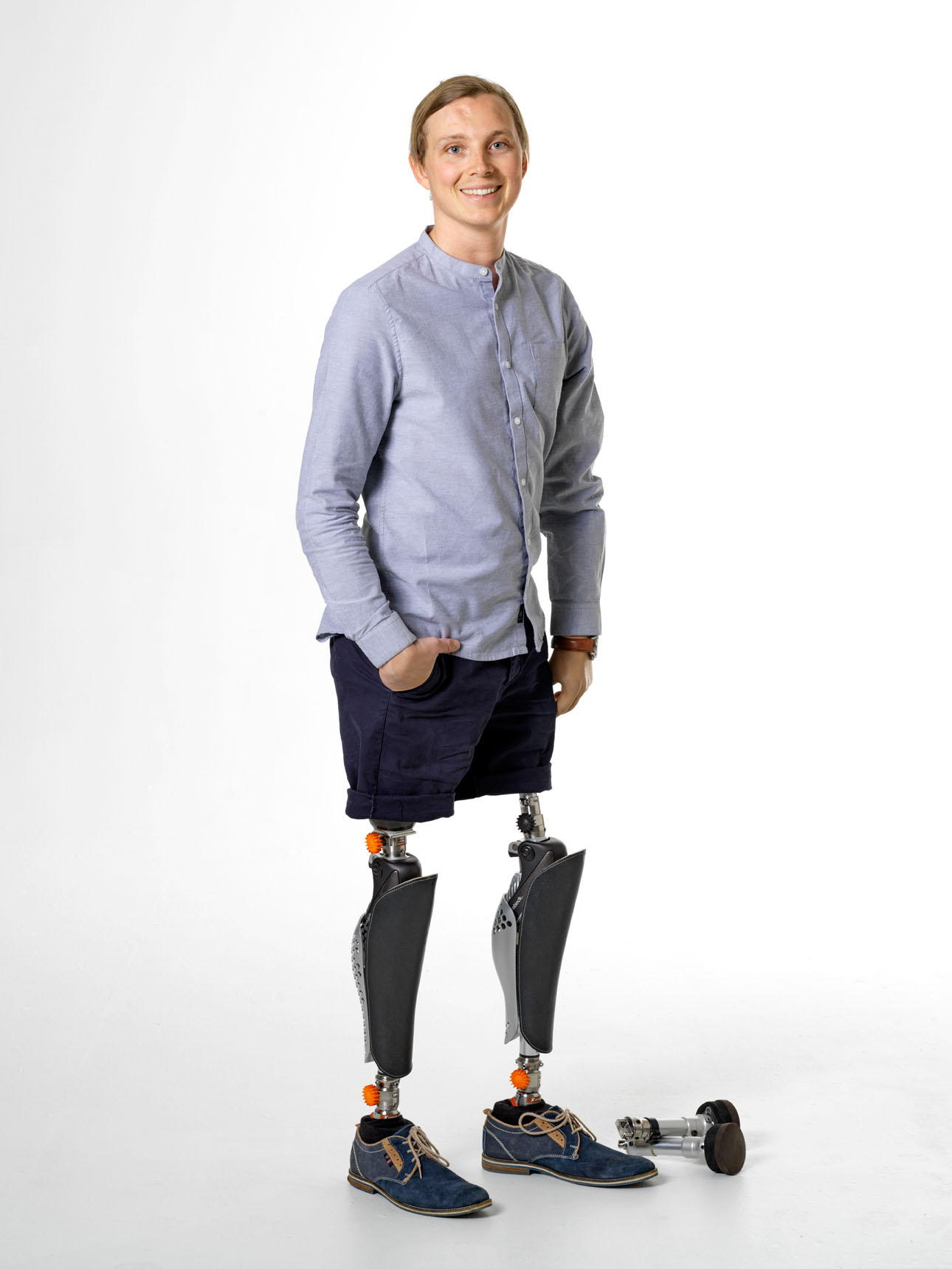 Christoffer Lindhe in a blue shirt with shorts standing on his long prosthetic legs