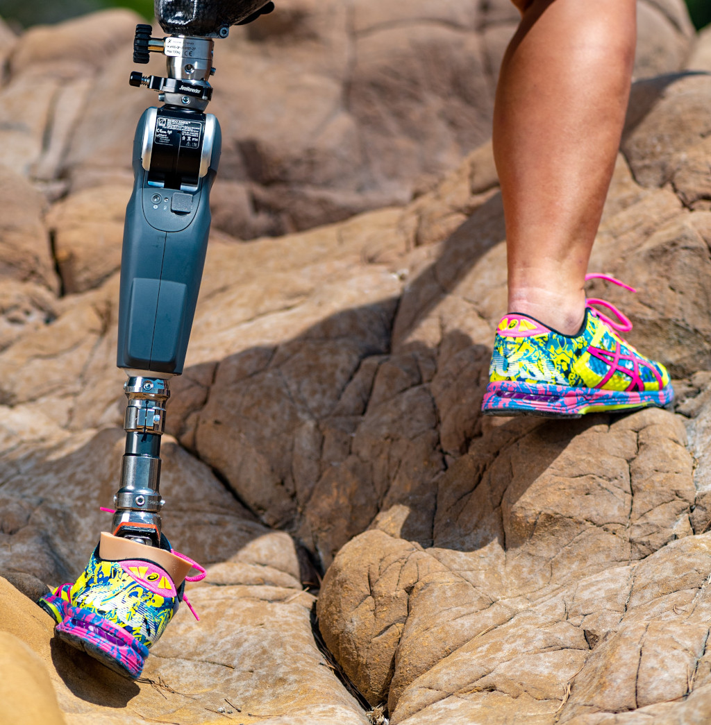 Femme amputée sous le genou escalade des rochers en utilisant le pied prothétique Xtend Foot sous le soleil de la France. Démonstration de la flexibilité du pied prothétique.